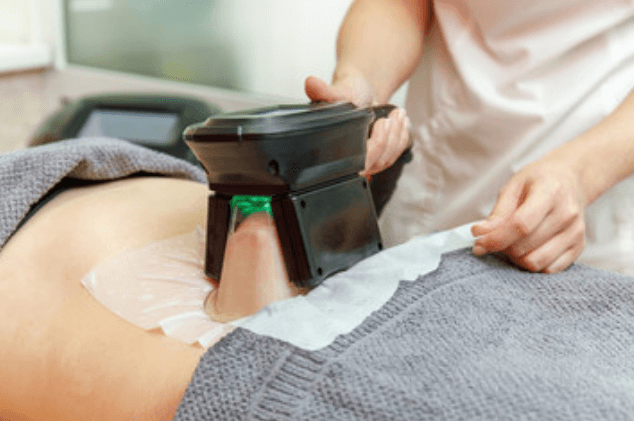 CoolSculpting West Melbourne