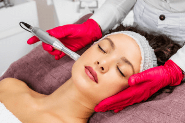 Microneedling West Melbourne