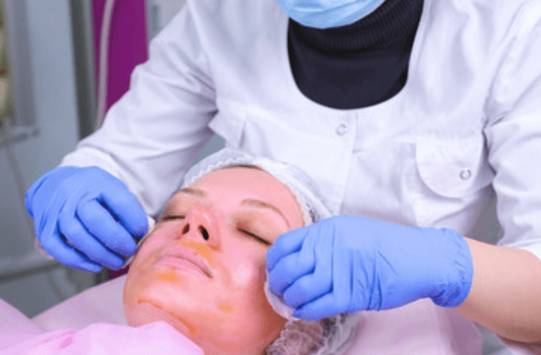 Chemical Peel West Melbourne