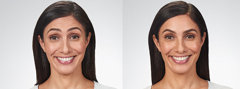 botox West Melbourne