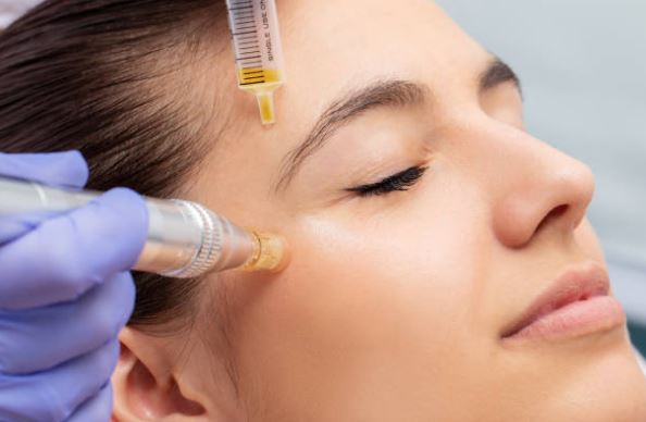 West Melbourne Microneedling