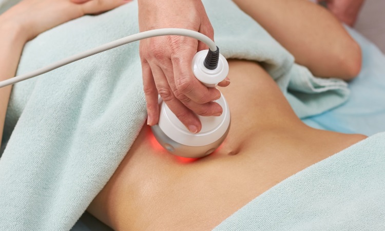 RF Body Treatments