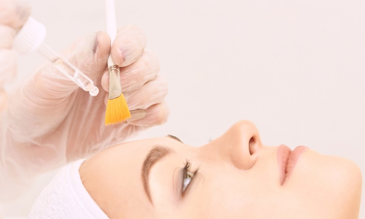 Chemical Peel West Melbourne